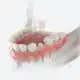 Navlake za zube Zaprešić - Ordinacija dentalne medicine Vedran Šebečić